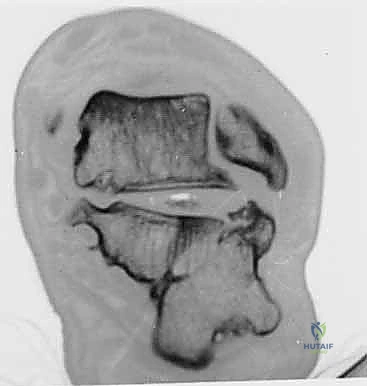 الأستاذ الدكتور محمد هطيف في غرفة العمليات