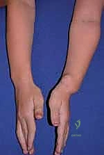Orthopedic Prometric MCQs - Chapter 3 Part 3