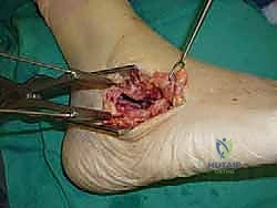 صور الأشعة المقطعية لتخطيط الجراحة