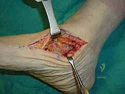 التحضير وتجهيز المريض للعملية