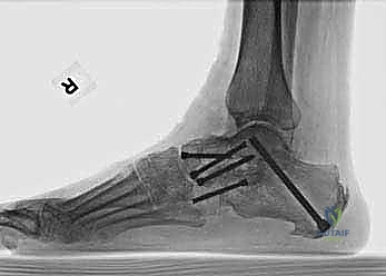 Clinical Image