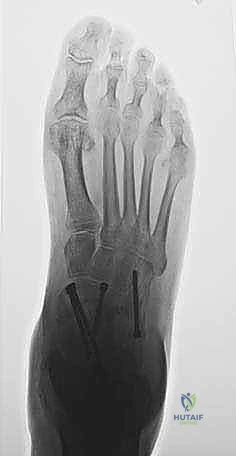 Clinical Image