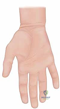 وصف طبي دقيق لمناطق الأوتار