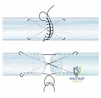 الأستاذ الدكتور محمد هطيف في غرفة العمليات