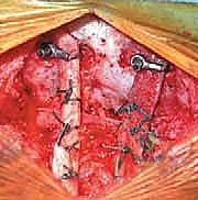 Clinical Image