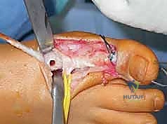 Clinical Image