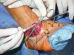 Clinical Image