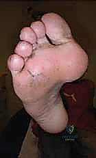 Clinical Image