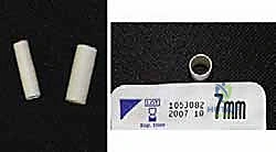 صورة توضيحية لـ علاج متلازمة النفق الرسغي واللفافة الأخمصية معًا: خبرة الأستاذ الدكتور محمد هطيف في صنعاء