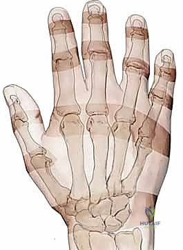 تقسيم مناطق الأوتار الباسطة في الأصابع