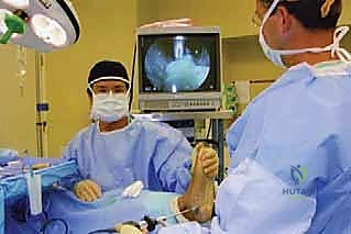 صورة توضيحية لـ بضع اللفافة الأخمصية بالمنظار: حل ثوري لآلام الكعب المزمنة في صنعاء مع الأستاذ الدكتور محمد هطيف