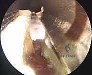 تجهيز المعدات الجراحية الدقيقة والمنظار