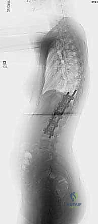 Clinical Image