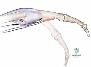 الفحص السريري لعدم استقرار الوتر