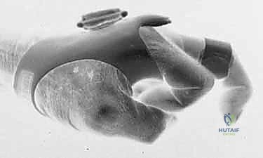 تشريح آلية الباسطة والرباط السهمي