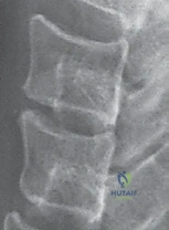 مقارنة الخيارات العلاجية