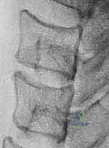 مناقشة خطة العلاج مع المريض