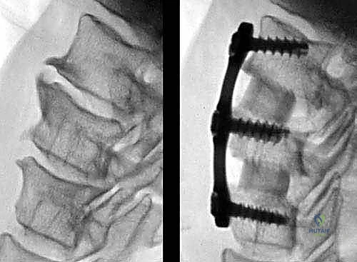 تقييم الأعراض العصبية