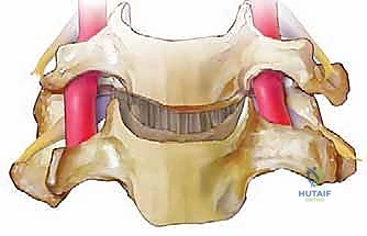 أحدث التقنيات الجراحية مع الدكتور هطيف