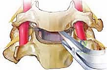 فحص المريض قبل الجراحة