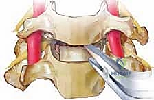استخدام الأشعة داخل العمليات