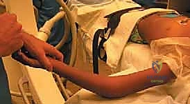 صورة توضيحية لـ كسور رأس وعنق الكعبرة: دليل شامل للتشخيص والعلاج والتعافي في صنعاء مع الأستاذ الدكتور محمد هطيف