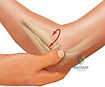 صورة توضيحية لـ كسور رأس وعنق الكعبرة: دليل شامل للتشخيص والعلاج والتعافي في صنعاء مع الأستاذ الدكتور محمد هطيف