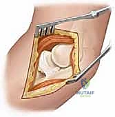 Clinical Image