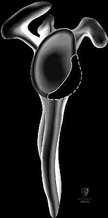 شكل الكمثرى المقلوبة في التجويف الحقاني