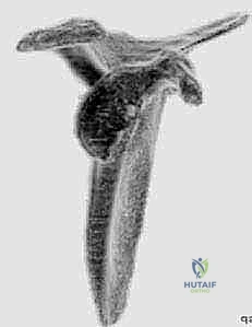 تخطيط الجراحة بناءً على الأشعة