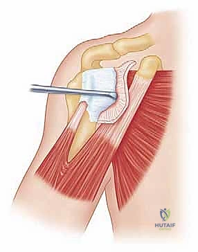 تجهيز المريض للعملية الجراحية