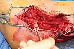 طرق التشخيص المتقدمة بالموجات فوق الصوتية وتخطيط الأعصاب