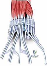 Mastering Flexor and Extensor Tenosynovectomy: An Intraoperative Masterclass for Rheumatoid Hand Surgery