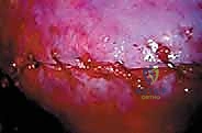 Clinical Image