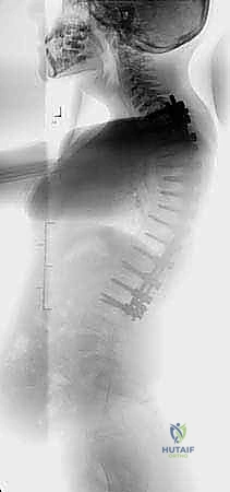 Clinical Image