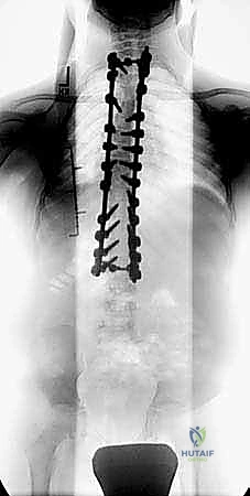 Clinical Image