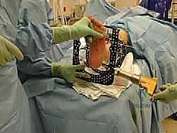 تركيب المفاصل المعدنية للإطار