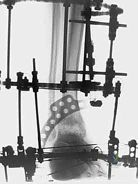 مقارنة بين التشتيت والدمج