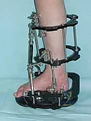 مريض يمارس حياته الطبيعية بعد التعافي