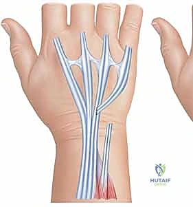 حالة مريض قبل وبعد الجراحة