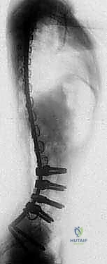 Illustration of instrumentation for neuromuscular - Dr. Mohammed Hutaif