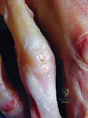 تأثير الإصابات الرياضية على مفاصل اليد