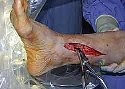 الأشعة السينية والتحضير قبل الجراحة