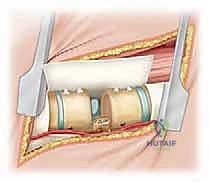 Clinical Image