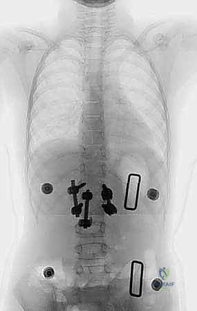 Clinical Image