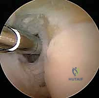 Clinical Image