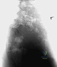 خدمات جراحة العظام في صنعاء