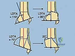 أربطة مفصل الكاحل