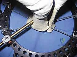 أنواع التشوهات الزاوية للساق