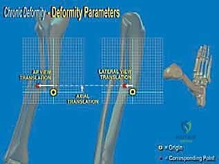 فحص سريري لتشوه الكاحل